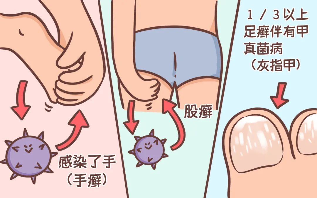 吕易圣艾灸液效果怎么样